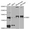 Glutamate Metabotropic Receptor 1 antibody, abx125910, Abbexa, Western Blot image 