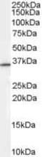 Ring Finger Protein 115 antibody, PA5-18484, Invitrogen Antibodies, Western Blot image 