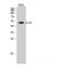 Interleukin 7 Receptor antibody, LS-C384126, Lifespan Biosciences, Western Blot image 