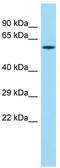 Matrix Metallopeptidase 27 antibody, TA331778, Origene, Western Blot image 
