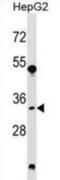 Spermidine Synthase antibody, abx029176, Abbexa, Western Blot image 