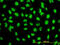 Serine/Threonine Kinase 38 antibody, LS-C133687, Lifespan Biosciences, Immunofluorescence image 
