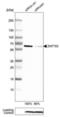 Zinc Finger Protein 703 antibody, NBP2-52940, Novus Biologicals, Western Blot image 