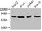 Checkpoint With Forkhead And Ring Finger Domains antibody, CSB-PA839315LA01HU, Cusabio, Western Blot image 