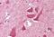 NK3 Homeobox 2 antibody, MBS243554, MyBioSource, Immunohistochemistry paraffin image 