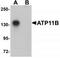 ATPase Phospholipid Transporting 11B (Putative) antibody, TA319848, Origene, Western Blot image 