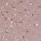 RUN And FYVE Domain Containing 3 antibody, NBP1-89614, Novus Biologicals, Immunohistochemistry paraffin image 