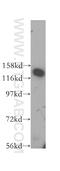 Nuclear Transcription Factor, X-Box Binding 1 antibody, 16387-1-AP, Proteintech Group, Western Blot image 