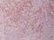 Glycogen Synthase Kinase 3 Alpha antibody, A03152-1, Boster Biological Technology, Immunohistochemistry frozen image 