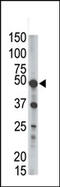 Phosphatidylinositol Glycan Anchor Biosynthesis Class K antibody, AP12209PU-N, Origene, Western Blot image 