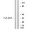 Major Histocompatibility Complex, Class II, DO Alpha antibody, A06776, Boster Biological Technology, Western Blot image 