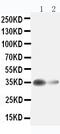 Arginase 1 antibody, GTX12102, GeneTex, Western Blot image 