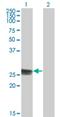 Thymidine Kinase 1 antibody, H00007083-M05, Novus Biologicals, Western Blot image 