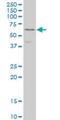 Dihydropyrimidinase Like 3 antibody, H00001809-M01, Novus Biologicals, Western Blot image 