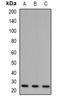 ADP Ribosylation Factor Like GTPase 2 Binding Protein antibody, orb382541, Biorbyt, Western Blot image 