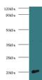 Cytochrome C Oxidase Subunit 4I1 antibody, LS-C318641, Lifespan Biosciences, Western Blot image 