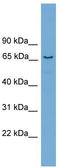 Protein Phosphatase 2 Regulatory Subunit B'Delta antibody, TA344610, Origene, Western Blot image 