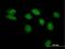 LRAT Domain Containing 2 antibody, H00286053-B01P, Novus Biologicals, Immunofluorescence image 