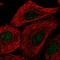 Transmembrane protein 92 antibody, HPA069820, Atlas Antibodies, Immunofluorescence image 