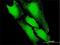 Prefoldin Subunit 5 antibody, H00005204-B03P, Novus Biologicals, Immunocytochemistry image 