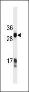 Kallikrein Related Peptidase 3 antibody, LS-C159838, Lifespan Biosciences, Western Blot image 