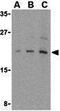 Eukaryotic Translation Initiation Factor 4E Binding Protein 1 antibody, GTX31714, GeneTex, Western Blot image 