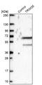 Tripartite Motif Containing 35 antibody, NBP1-81733, Novus Biologicals, Western Blot image 