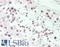 Fibrillarin antibody, LS-B13537, Lifespan Biosciences, Immunohistochemistry paraffin image 