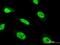 Zinc Finger Protein 71 antibody, MA5-22424, Invitrogen Antibodies, Immunofluorescence image 