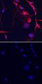 ST6 N-Acetylgalactosaminide Alpha-2,6-Sialyltransferase 5 antibody, MA5-24336, Invitrogen Antibodies, Immunocytochemistry image 