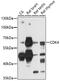 Calcium/Calmodulin Dependent Protein Kinase IV antibody, GTX53923, GeneTex, Western Blot image 