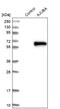 Ajuba LIM Protein antibody, NBP1-89570, Novus Biologicals, Western Blot image 