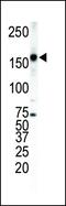 Erb-B2 Receptor Tyrosine Kinase 4 antibody, PA5-14638, Invitrogen Antibodies, Western Blot image 