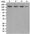 DNA Topoisomerase II Beta antibody, ab109524, Abcam, Western Blot image 