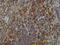 Linker For Activation Of T Cells antibody, LS-C133721, Lifespan Biosciences, Immunohistochemistry frozen image 