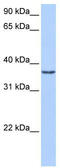 Vestigial Like Family Member 2 antibody, TA339814, Origene, Western Blot image 