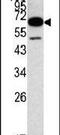 Methionyl Aminopeptidase 2 antibody, PA5-12135, Invitrogen Antibodies, Western Blot image 