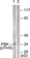 PDZ Binding Kinase antibody, LS-C199413, Lifespan Biosciences, Western Blot image 