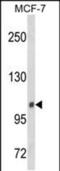 Inositol Polyphosphate-4-Phosphatase Type II B antibody, PA5-49656, Invitrogen Antibodies, Western Blot image 