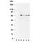 Matrix Metallopeptidase 2 antibody, R30290, NSJ Bioreagents, Western Blot image 