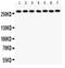 Leucine Rich Repeat Kinase 2 antibody, PB9281, Boster Biological Technology, Western Blot image 
