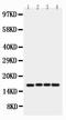 Baculoviral IAP Repeat Containing 5 antibody, PA1474, Boster Biological Technology, Western Blot image 