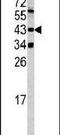 Lysine Methyltransferase 5A antibody, PA5-13496, Invitrogen Antibodies, Western Blot image 