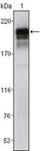 Platelet Derived Growth Factor Receptor Beta antibody, abx011361, Abbexa, Enzyme Linked Immunosorbent Assay image 