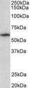 TXK Tyrosine Kinase antibody, MBS421849, MyBioSource, Western Blot image 