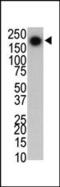 Leucine Rich Repeat Kinase 2 antibody, MA5-11154, Invitrogen Antibodies, Western Blot image 