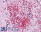 Polo Like Kinase 1 antibody, LS-B4225, Lifespan Biosciences, Immunohistochemistry paraffin image 