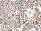 Cytoplasmic dynein 1 intermediate chain 2 antibody, GTX112419, GeneTex, Immunohistochemistry paraffin image 