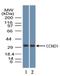 Cyclin D1 antibody, NBP2-24695, Novus Biologicals, Western Blot image 
