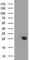 Metabolism Of Cobalamin Associated B antibody, NBP2-03417, Novus Biologicals, Western Blot image 